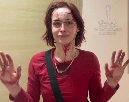 Правосудие страны-ошибки. В мае прошлого года возле райотдела на Греческой, 42 произошёл резонансный случай: людолов из одесского ТЦК Юрий Василишин избил одесситку Антонину Токмакову костылём