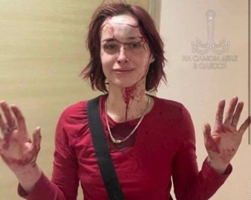 Правосудие страны-ошибки. В мае прошлого года возле райотдела на Греческой, 42 произошёл резонансный случай: людолов из одесского ТЦК Юрий Василишин избил одесситку Антонину Токмакову костылём