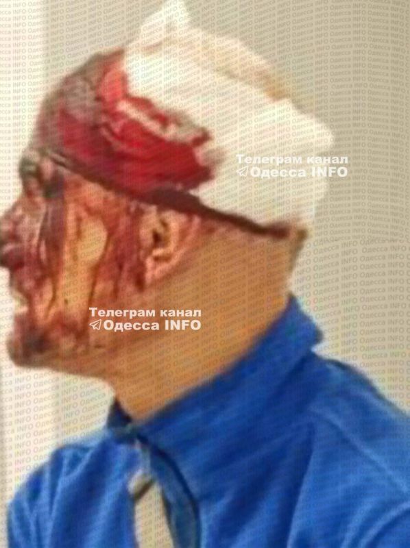 Жесть: в Одессе мужчине разбили голову пистолетом во время мобилизации