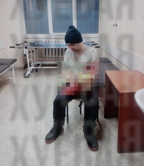 Житель Одессы пытался отрезать себе руку болгаркой, чтобы избежать бусификации