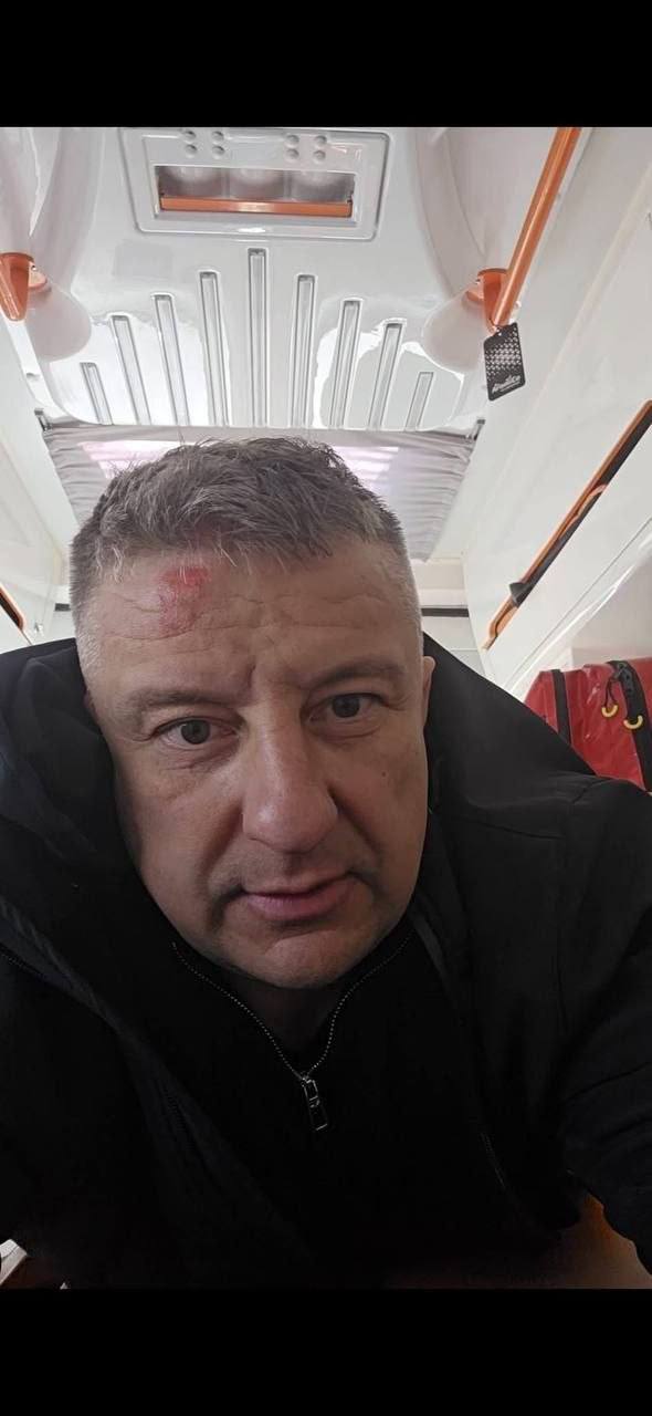 Одесские военкомы жестоко избили мужчину и бросили его на дороге