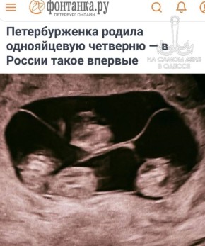 Редчайшее явление в генетике и репродуктивной медицине, если верить изданию «Фонтанка», зафиксировано в Петербурге